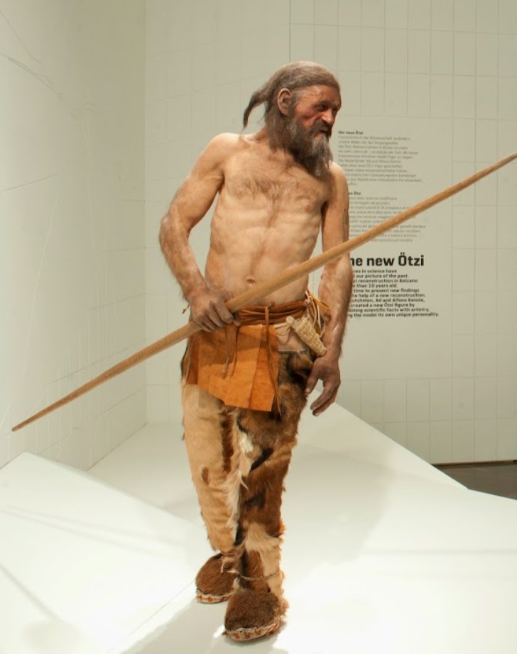 The prehistoric Similaun man treated with acupuncture: Ötzi or Öetzi, the Iceman
